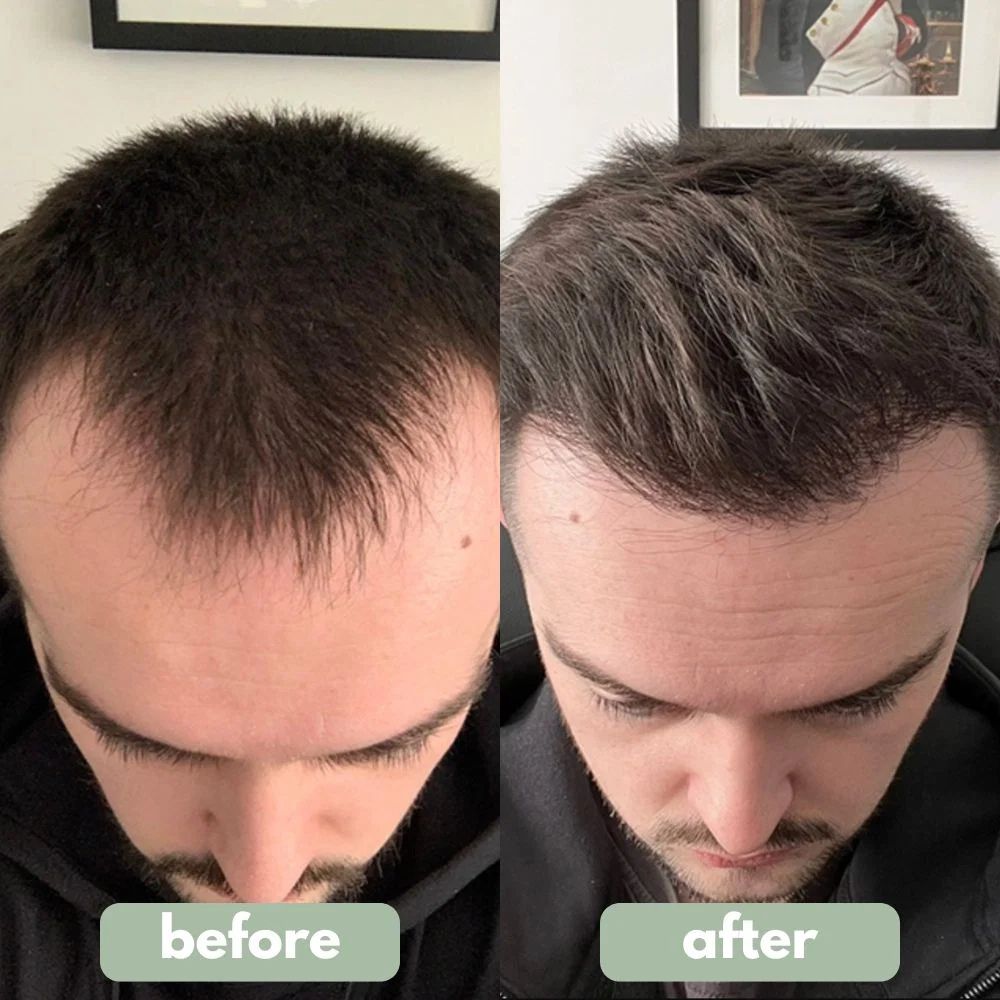 Yagoo™ Labss - Hair Growth Serum
