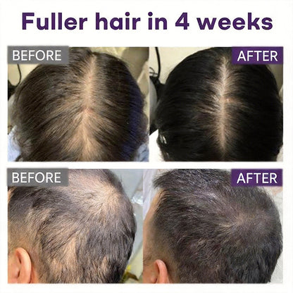 🔥Yagoo™ Black Rice & Red Onion Hair Growth Spray