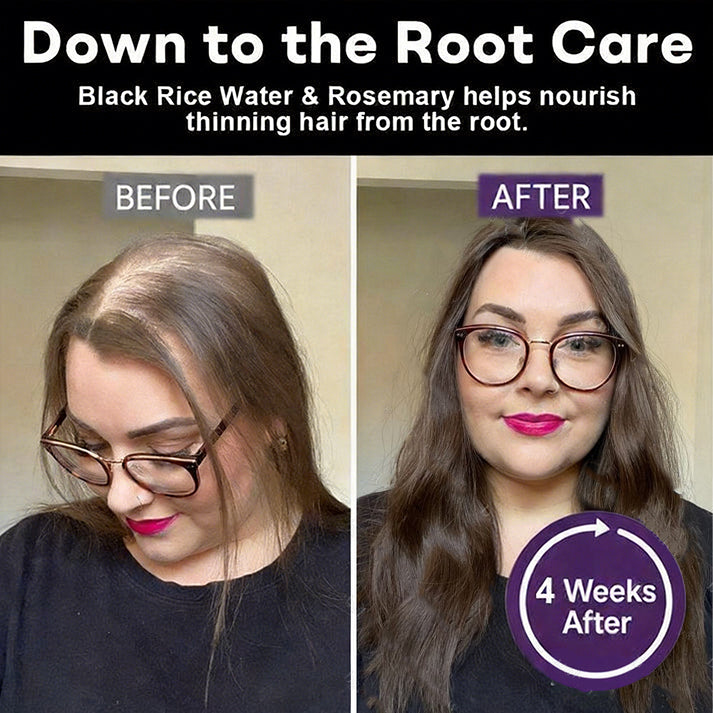 🔥Yagoo™ Black Rice & Red Onion Hair Growth Spray