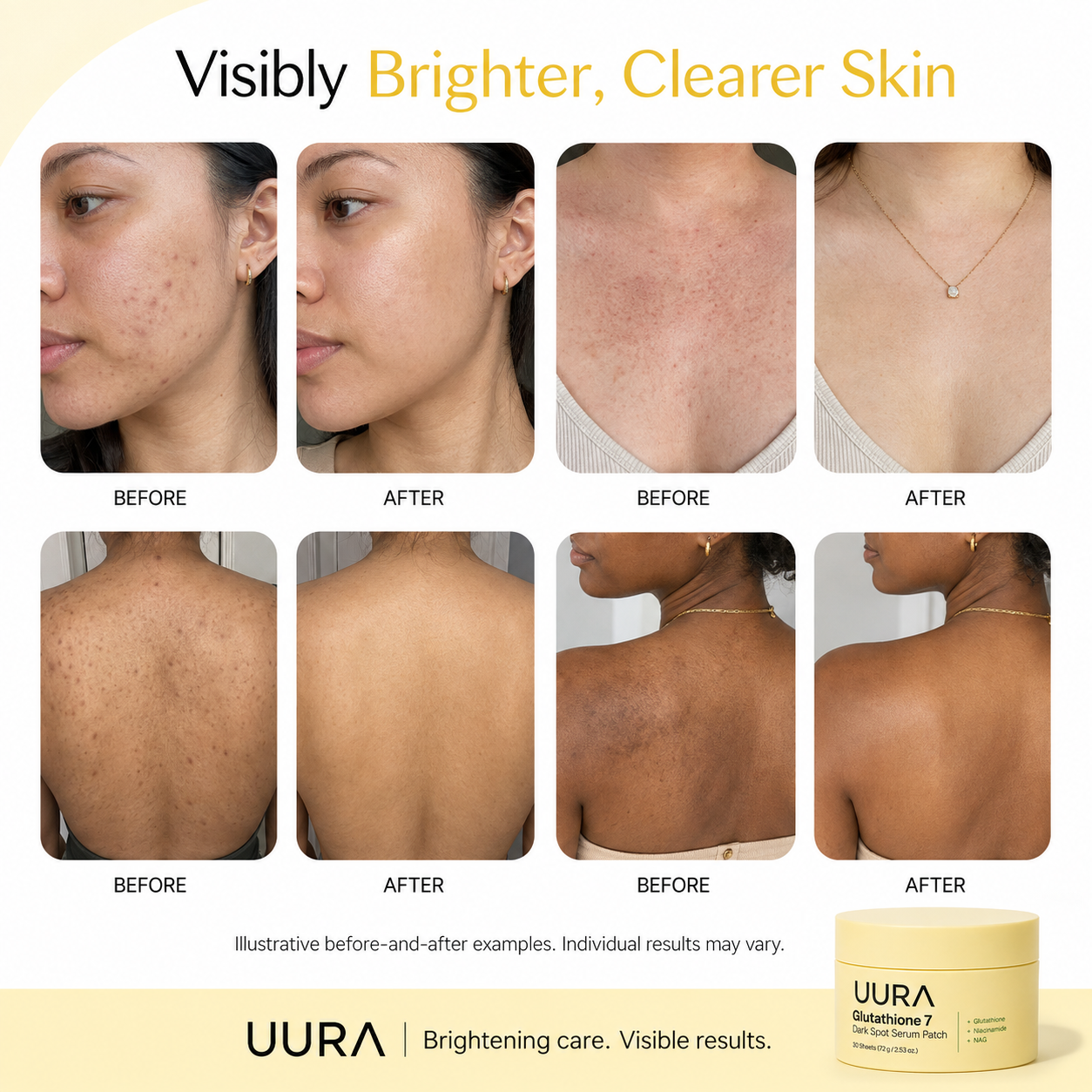Glutathione 7 Dark Spot Serum Patch